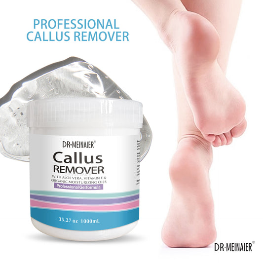 Callus remover